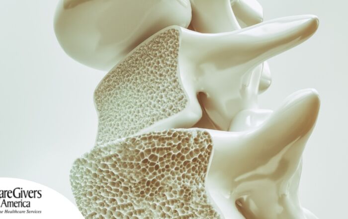 An image of a spine with the inside exposed represents osteoporosis.