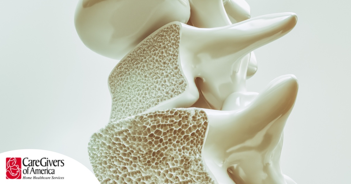 An image of a spine with the inside exposed represents osteoporosis.